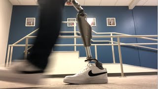 Hip disarticulation prosthetic gait demonstration 2022 [upl. by Godric365]