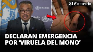 VIRUELA DEL MONO OMS declara EMERGENCIA de SALUD PÚBLICA INTERNACIONAL  El Comercio [upl. by Ahsined]