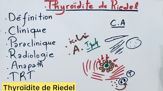 Thyroïdite de Riedel [upl. by Adiraf527]