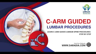 🎯CArm Guided Transforaminal Epidural Steroid Injection amp Facet Joint Injection StepbyStep Guide🚀 [upl. by Siravrat]