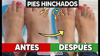 🦶🏻🔥 4 FORMAS de disminuir los PIES HINCHADOS durante el embarazo [upl. by Veleda]