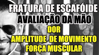 Fratura de Escafóide Avaliação da Dor ADM e Força Muscular  Anatomia Humana  VideoAula 102 [upl. by Atillertse]