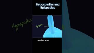 Hypospadias and Epispadias Complete course link available in comment [upl. by Innad528]