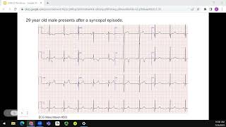 Dr Tang  ECG Workshop [upl. by Ynnot]