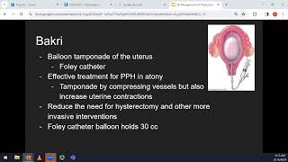 Dr Cung  Small Talks  Postpartum Hemorrhage [upl. by Klemperer]