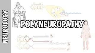 Approach to Polyneuropathy  causes pathophysiology investigations [upl. by Noret]