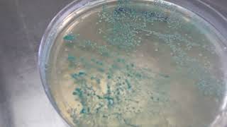 Candida albican on candida deferential agar plate  Budding yeast [upl. by Quintilla]