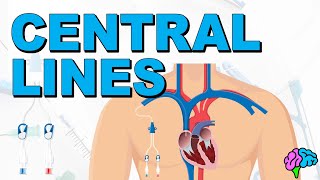 The Basics of Central Lines  Central Venous Catheters CVC [upl. by Pfosi887]