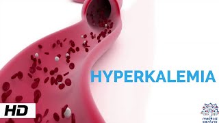 HYPERKALEMIA Causes Signs and Symptoms Diagnosis and Treatment [upl. by Aij554]