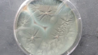 penicillium growth on SDA [upl. by Acsicnarf]