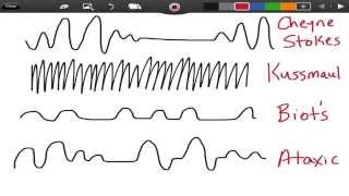 Irregular Breathing Patterns  EMTprepcom [upl. by Ainosal502]