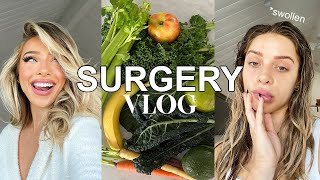 VLOG Fixing my Smile Gum Graft Surgery Tips to Heal and Recover Eating 30 Fruits and Veggies [upl. by Ellenhoj]