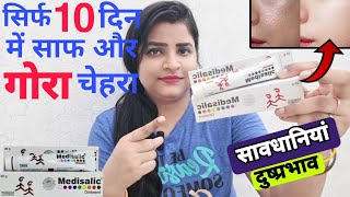 Medisalic Cream Review in Hindi  गोरेपन की क्रीम  Medisalic Cream Side effects Uses and Results [upl. by Christophe]