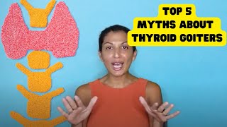 Top 5 myths about thyroid goiters with Dr Roy — Dont believe everything you hear [upl. by Huff315]