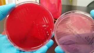 Microbiology Body Site Normal Flora vs Pathogens A Visual Review [upl. by Huggins]