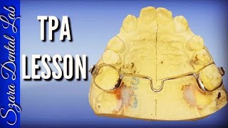 How to make a Transpalatal Arch TPA Orthodontic appliance by Szara [upl. by Nyrb]