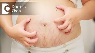 How to manage pregnancy rashes  Dr Tina Ramachander [upl. by Cris]