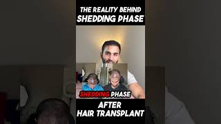 Truth behind shedding phase after hair transplant short [upl. by Naesyar825]