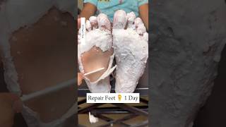 Repair Cracked Heels In 1Day  Get Rid Of Dry Feet  Get Fair amp Soft Feet Instantly cracked shorts [upl. by Derman]