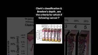 Quickquiz 49pathologylectures pathology [upl. by Terrene760]