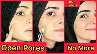 How To Get Rid Of Open Pores On Face  100 Results Guaranteed  Dietitian Aqsa [upl. by Wiebmer580]