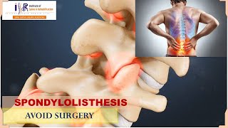 ISR Jaipur  It Is All About Spondylolisthesis Avoid Surgery  By Dr Sky Sharma [upl. by Alasdair989]