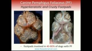 Pemphigus Foliaceus – Recent update on Pathogenesis Diagnostic and Treatment [upl. by Shana]