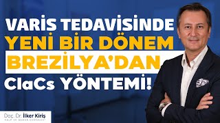 ESTETİK VARİS TEDAVİSİNDE BREZİLYADAN CLaCS YÖNTEMİ NEDİR [upl. by Eecyac295]