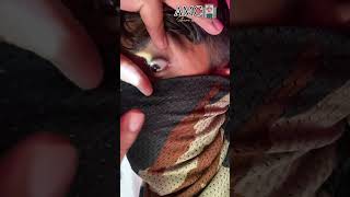 Anisocoria EYE 👁️ Medical points 🤔 आप भी चेक कर लो armymedical viralvideo [upl. by Hallie]