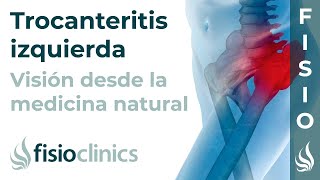 Trocanteritis izquierda Visión desde la fisioterapia y la medicina natural  FisioClinics Palma [upl. by Ettezzus]