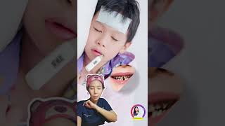 โหดมั้ยละ แค่ฟันผุ หมอป่อง hachidentalclinic veneers shortyoutube vlog ฟันผุ อุดฟัน [upl. by Tamar]