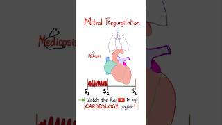 Mitral Regurgitation MR  Valvular Heart Disease VHR…cardio anatomy mbbs science nclex [upl. by Donnamarie]