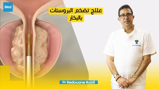 Pr Redouane Rabii  علاج تضخم البروستات بالبخار [upl. by Leina]