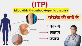 ITP बीमारी क्या है । प्लेटलेट की कम रहने का कारण । Thrombocytopenia symptoms and treatment । [upl. by Sairahcaz]