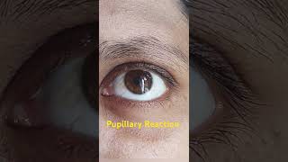 Pupillary reaction in eye [upl. by Rengaw]