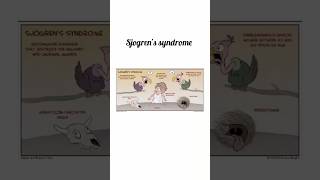 Sjogrens Syndrome kattrucate medicalreels sjogren syndrome immune drymouth jointpain short [upl. by Nerra]