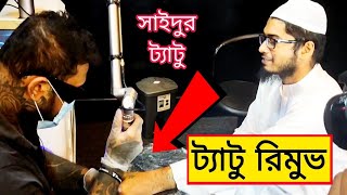 How Laser Tattoo Removal Works Bangladesh । BD Tattoo Remove Center Dhaka । How To Work 😱 lets see [upl. by Nnaecyoj103]