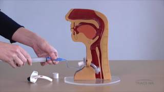 Tracheostomy  Respiratory phonatory and swallowing function  TRACS WA [upl. by Reisfield]