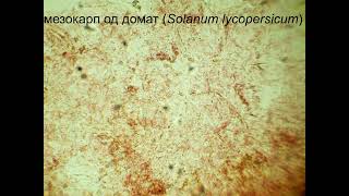 Мезокарп од домат Solanum lycopersicum [upl. by Josephson]