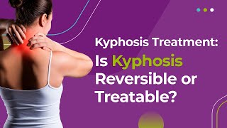 Kyphosis Treatment Is Kyphosis Reversible or Treatable [upl. by Higginbotham]