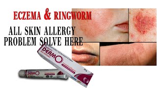 eczema Skin allergy homeopathy madicine Radients DERMO skin ointment ringworm best madicine [upl. by Arymas]