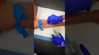 How to Draw Blood Using a Butterfly Needle Phlebotomy Program Guide [upl. by Dorreg192]