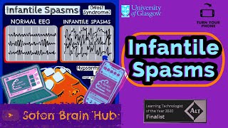 Infantile Spasms [upl. by Anderson]