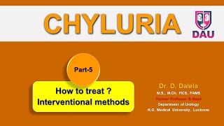 CHYLURIA treatment by interventional methods [upl. by Ekalb]