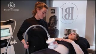 LPG Endermologie behandeling in Amsterdam [upl. by Eelrehpotsirhc]