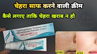 melacare forte cream  melacare forte cream uses in hindi  melacare cream  Prince Azeemuddin [upl. by Marron129]