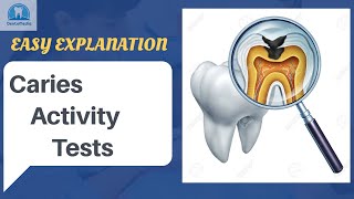 Caries Activity Tests Easy Explanation [upl. by Furtek]