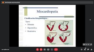 2P  Miocardiopatías  Fisiopatología [upl. by Pasol]