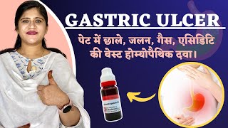 Gastric ulcer  पेट में छाले जलन बदहज़्मी की बेस्ट दवा  Peptic ulcer Treatment  Dr Arwa Bohra [upl. by Rori]