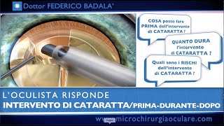 Intervento di Cataratta Cosa Succede Prima Durante e Dopo L’Oculista Risponde [upl. by Nareht56]